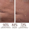 image:imageNuFACE NuBODY Toning Device  FDA Cleared Microcurrent Device for AllOver Contouring Firming amp Skin TighteningNEW Core Device  Clean Formula