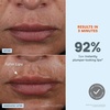 image:imageNuFACE The Power Move Glass Skin Bundle  FIX MicroWand Microcurrent Device IonPlex HydraGel Power Mask 5Pack  Depuff Plump amp Smooth for Radiant GlassLike Skin