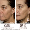 image:imageNuFACE Hydrate  Sculpt Microcurrent Facial Device Gift Set 6 Piece